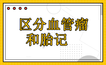 广州血管瘤专科医院-区分血管瘤和胎记